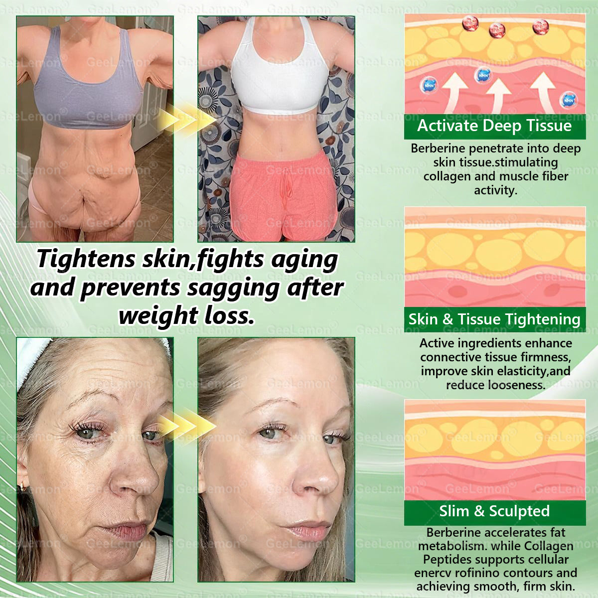 ✅𝐆𝐞𝐞𝐋𝐞𝐦𝐨𝐧® 𝐌𝐨𝐫𝐢𝗻𝗴𝗮 · 𝐁𝐞𝐫𝐛𝗲𝗿𝗶𝗻𝗲 × 𝗡𝗔𝗗+ 𝟏𝟎 𝐢𝐧 𝟏 𝐀𝐝𝐯𝐚𝐧𝐜𝐞𝐝 𝗡𝗮𝗻𝗼 𝗠𝗶𝗰𝗿𝗼𝗻𝐞𝐞𝐝𝐥𝐞 𝐏𝐚𝐭𝗰𝗵👩‍⚕️👩‍⚕️(Just once a day, visible changes in 7 days) ✅ For obesity, loose skin, diabetes, and more.
